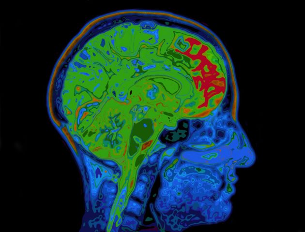 Brain Mri Scan